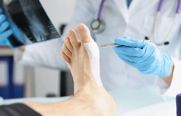 Hallux Valgus: Ursachen, Diagnose und Operation