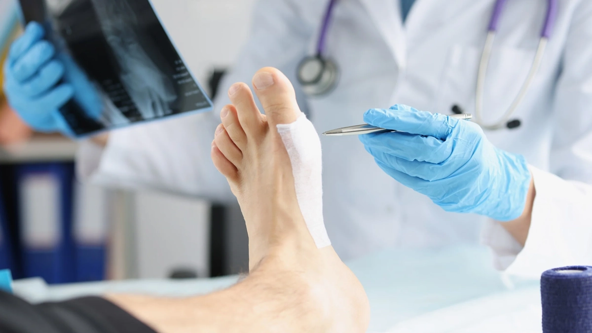 Hallux Valgus: Ursachen, Diagnose und Operation